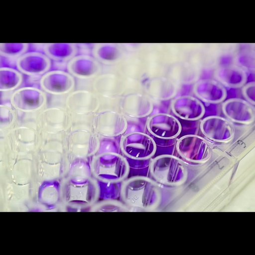 [0812-SL0152Mo] Mouse Corticosterone,CS ELISA kit, 96 tests